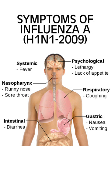 influenza symptoms